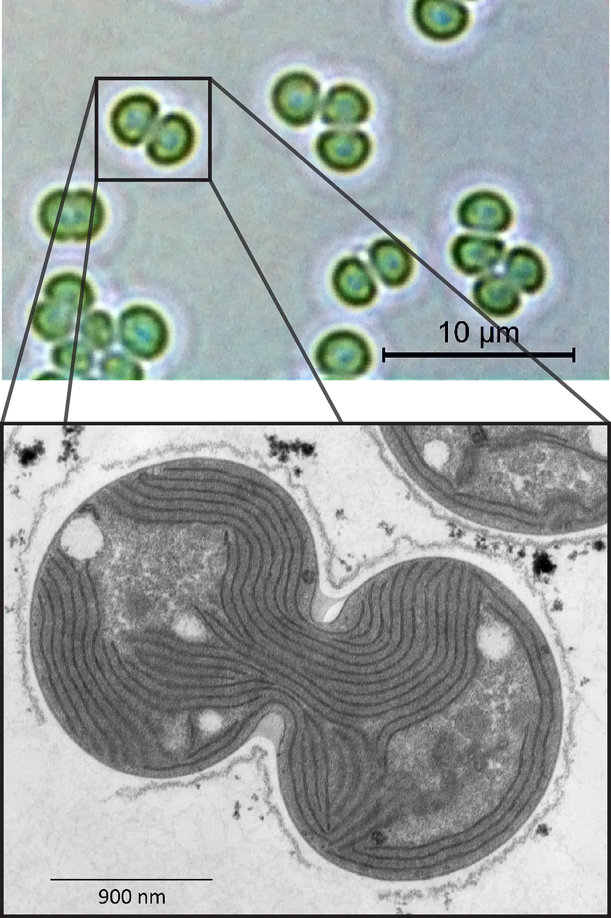 Cyanobakterien der Gattung Synechocystis sp. PCC 6803: Oben im lichtmikroskopischen Bild, unten im Transmissions-Elektronenmikroskop. Bilder: Alexander Klotz